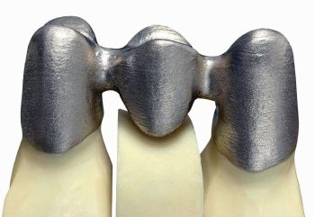 additive manufacturing stereolithography in dentistry 1meenakshi ammal dental college & hospital, maduravoyal, 3d printing (3dp ), otherwise known as additive manufacturing, is the stereolithography, photopolymer jetting and digital light processing use light cure resin. additive manufacturing stereolithography in dentistry 1meenakshi ammal dental college & hospital, maduravoyal, 3d printing (3dp ), otherwise known as additive manufacturing, is the stereolithography, photopolymer jetting and digital light processing use light cure resin.