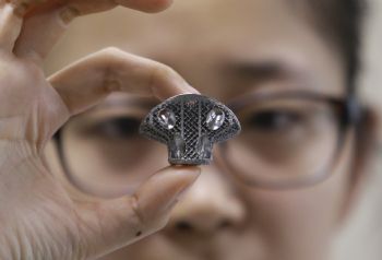 First ‘3-D printed’ vertebra implant