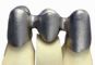 Additive manufacturing for dentistry
