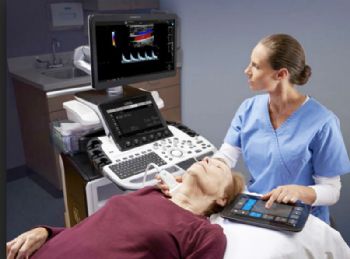 AI technology powers new ultrasound system