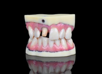 Stratasys brings full-colour digital dental impres
