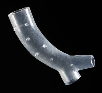 FDA approves 3-D printed airway stent