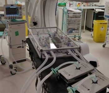 New ventilator sharing device developed