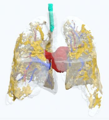 Axial3D helps doctors understand Covid-19