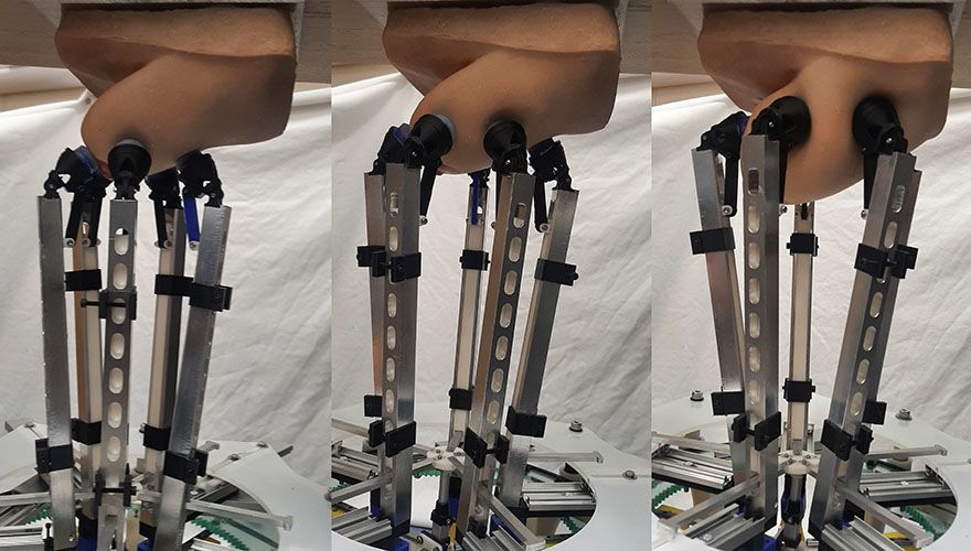 New robot could help diagnose breast cancer early