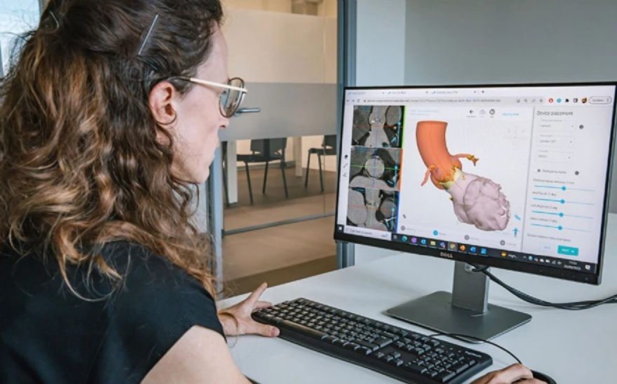 Materialise expands cardiovascular capabilities