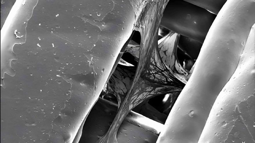 Bone tissue engineering with 3-D printing
